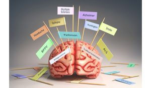 اختلالات سیستم عصبی