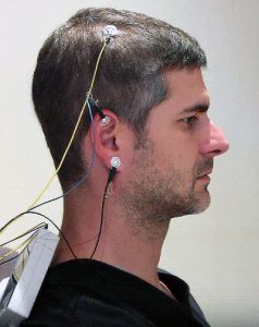 tDCS (تحریک الکتریکی مغز)