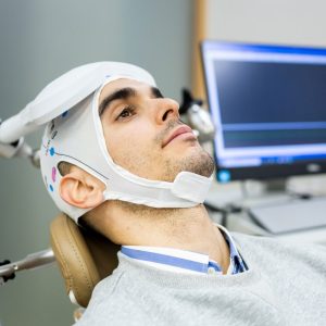 سردرد بعد از rTMS