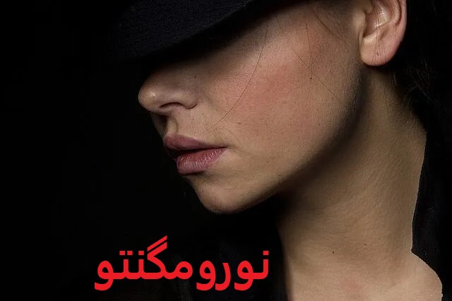 نورومگنتو
