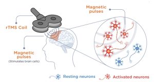نوروپلاستیسیتی چیست؟
