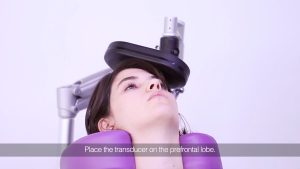کنترل عوارض rTMS با قرار دادن کویل در محل مناسب